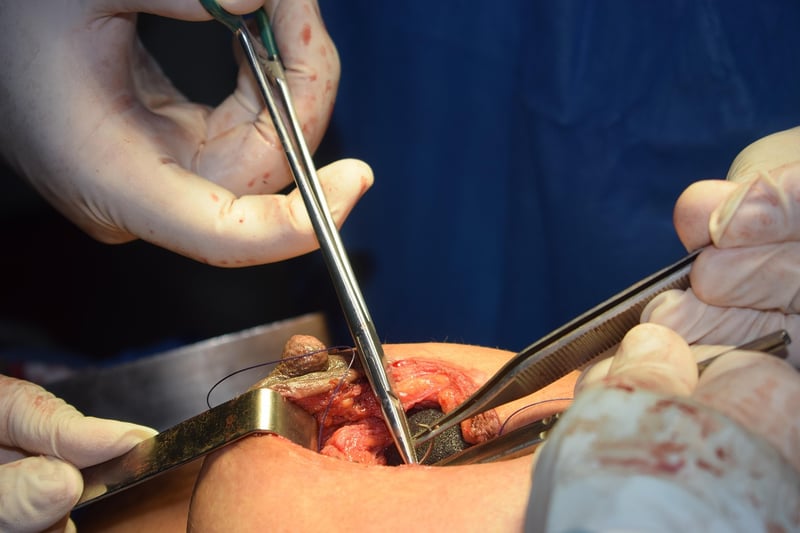 Plastic surgery speculations